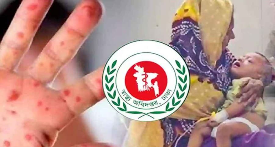 বাংলাদেশে হামের ভয়াবহ প্রকোপ: মাত্র ৫৫ দিনে ৪০০-রও বেশি শিশুর মৃত্যু